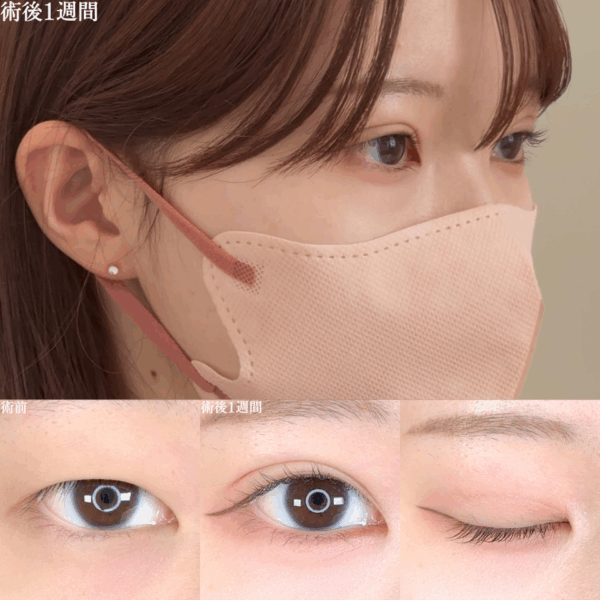 No.8633の症例写真